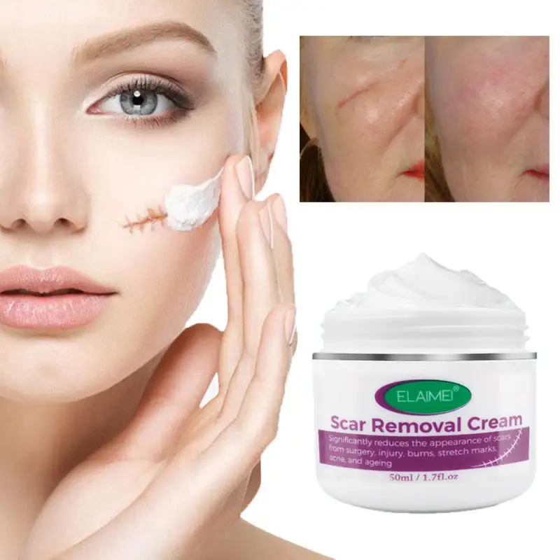 Crema de Gel para eliminar cicatrices, crema reparadora para el cuidado de la piel, crema reafirmante antienvejecimiento, TSLM1